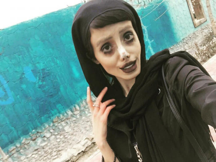A făcut zeci de operații pentru a semăna cu Angelina Jolie. Rezultatul, dezastruos