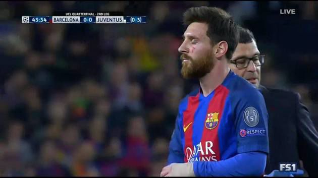 Meciul dintre Barcelona şi Juventus: Messi a căzut îngrozitor