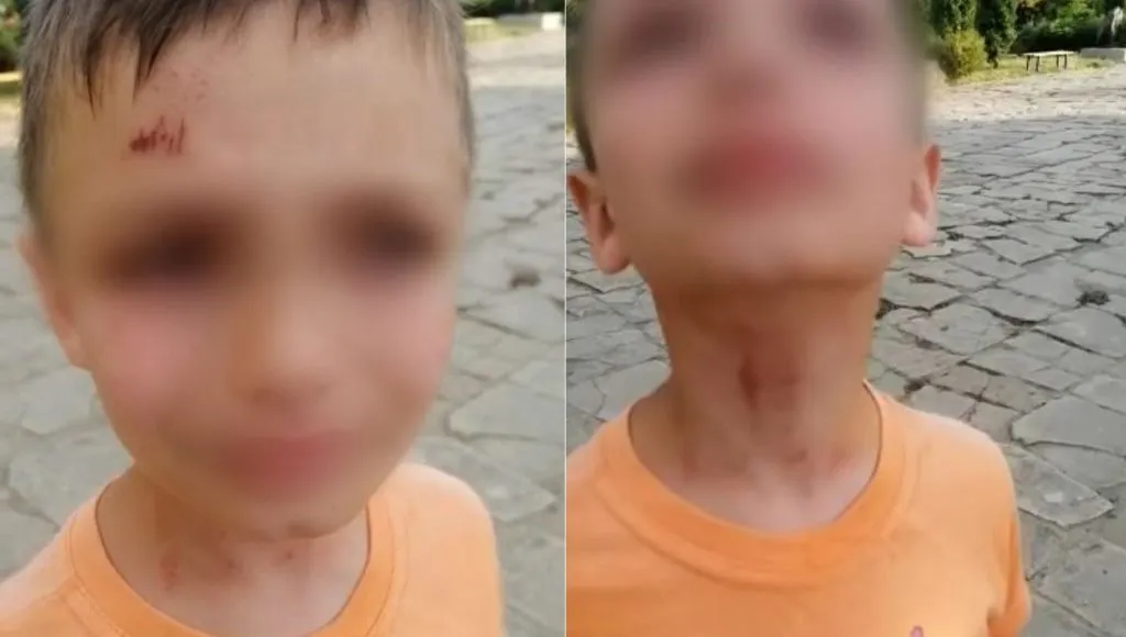 Один из детей, избитых пограничником: Я боюсь выходить на улицу