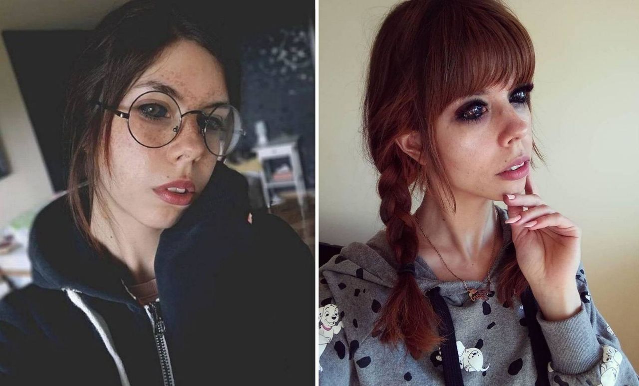 Модель, которая хотела стать похожей на кумира, ослепла из-за чернил в глазных яблоках