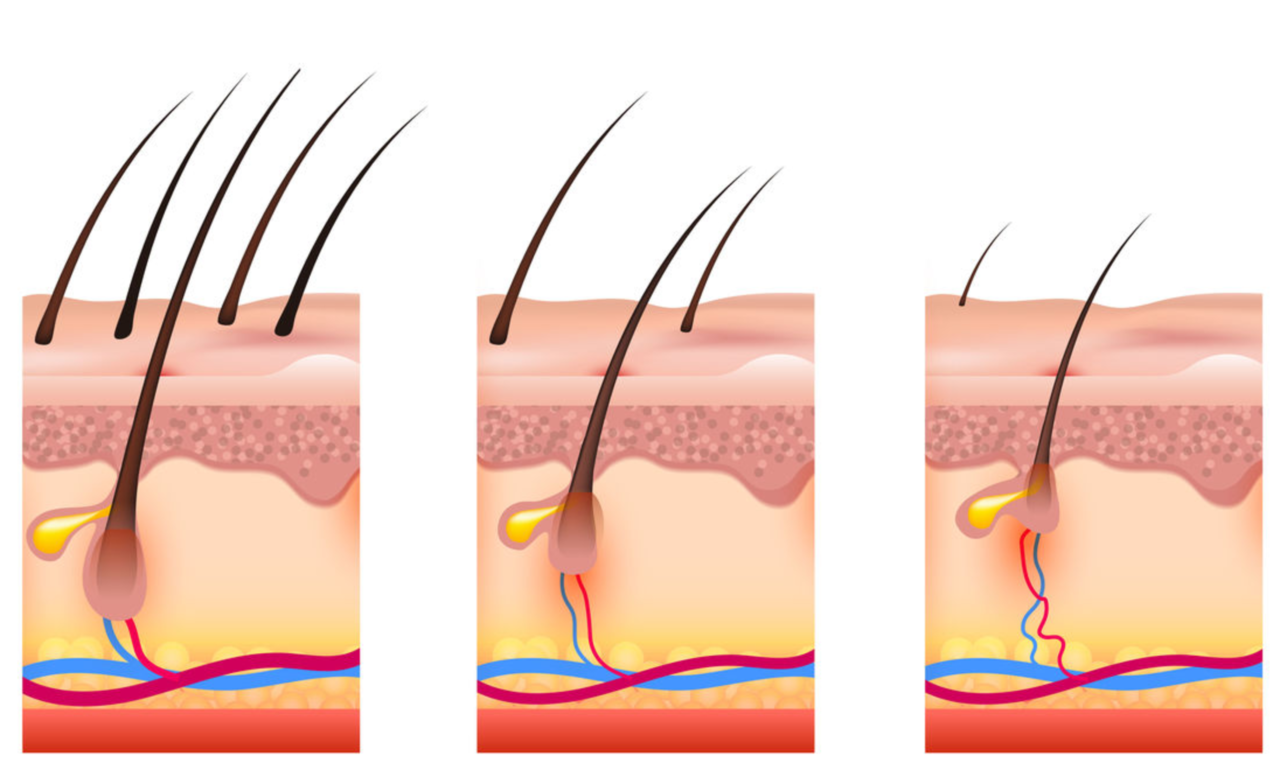 Viorica-Cosmetic: Почему выпадают волосы и как этого избежать