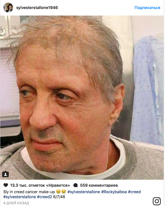 Imagini tulburătoare cu Sylvester Stallone. Ce s-a întâmplat cu actorul
