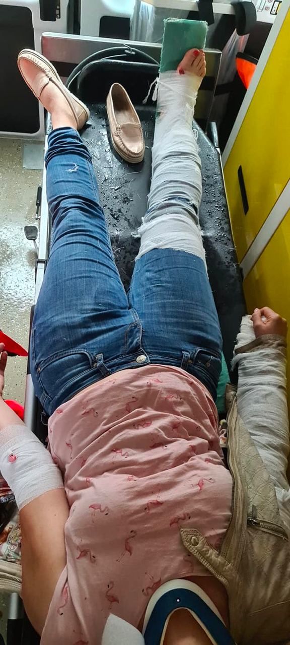 На Буюканах на пешеходном переходе сбили двух человек, включая ребенка
