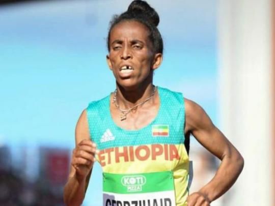 Сеть поразило фото 16-летней эфиопки, которая выглядит как пенсионерка