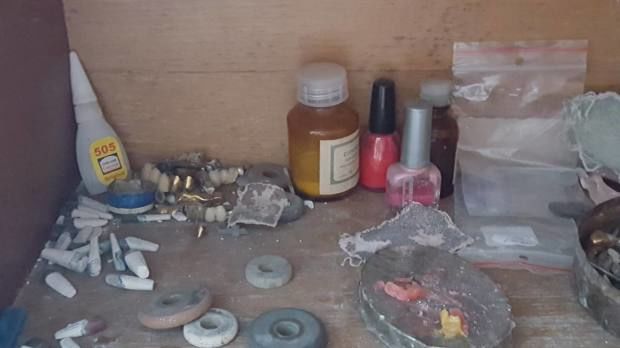 Un bărbat din Drochia și-a improvizat la domiciliu o stomatologie ilegală