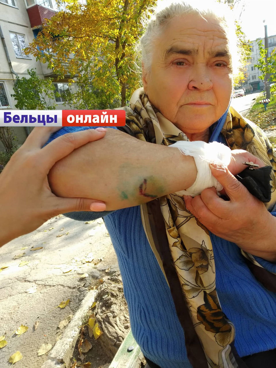 В Бельцах на 78-летнюю пенсионерку напали три собаки