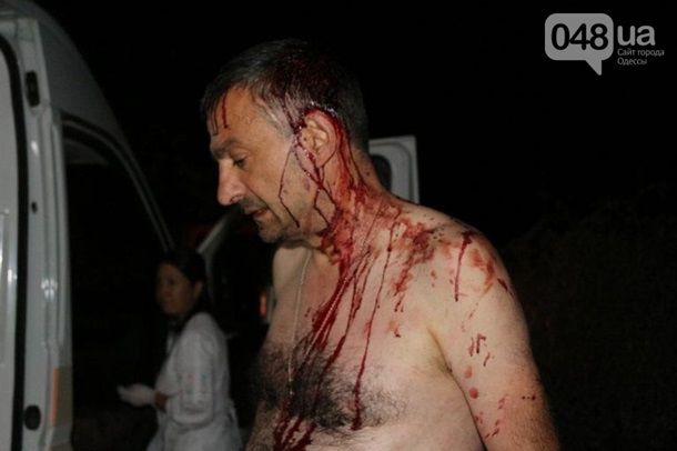 В Одесской области три человека с битами напали на журналиста