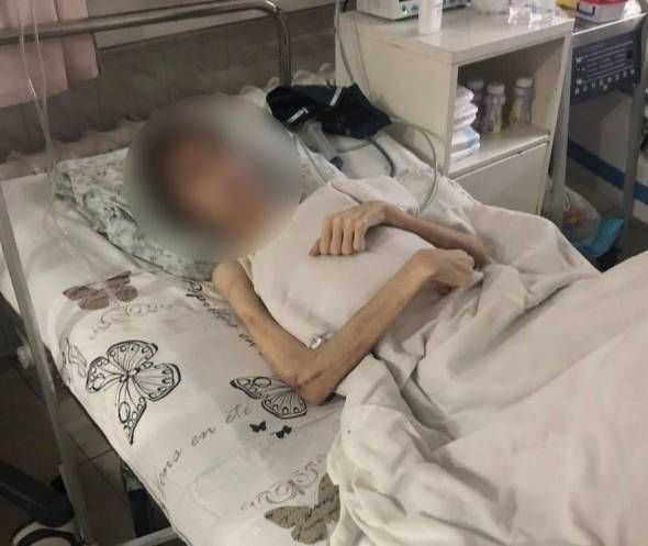 В Одессе отец довёл 16-летнего сына до веса в 30 кг, спасая от бесов