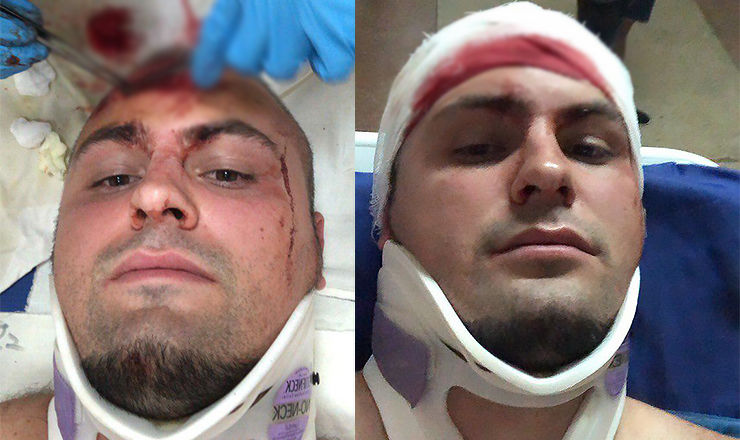 Водитель BMW: Я ехал на зеленый сигнал светофора