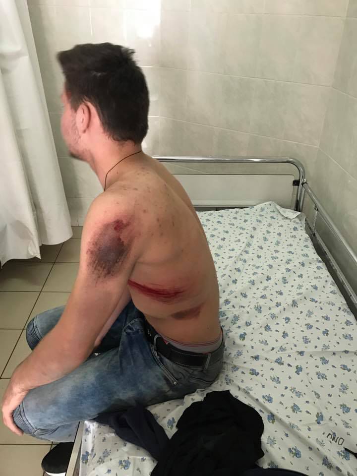 Автоледи в Кишиневе сбила подростка и скрылась с места ДТП