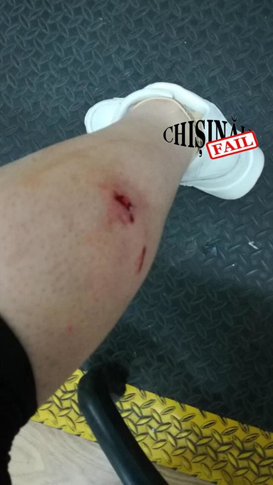 В центре столицы стая бродячих собак покусала женщину