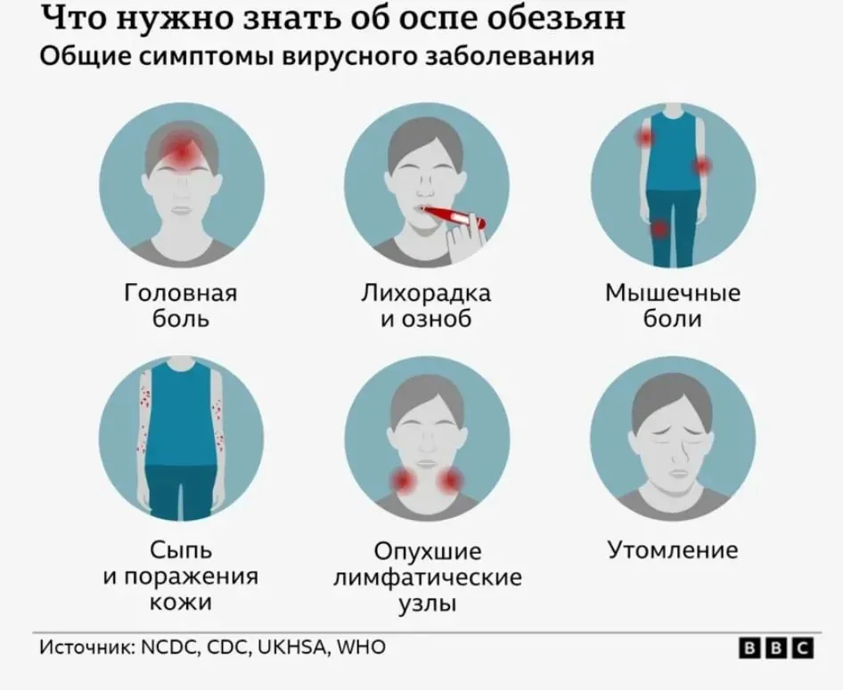 Expert OMS: Variola maimuței nu este un nou COVID. Metodele de combatere sunt clare