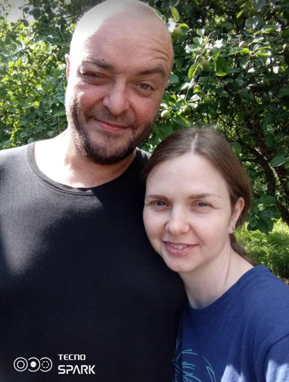 Музыкант «Кукрыниксы», предположительно, сам отрубил руку из-за болей от экземы