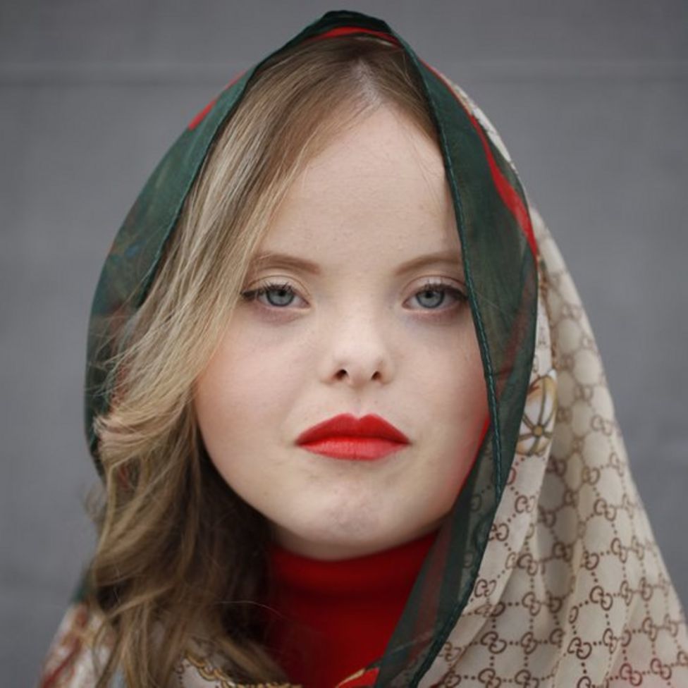 Девушка с синдромом Дауна стала моделью, увидев рекламную кампанию Gucci