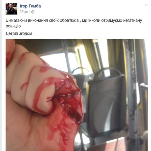В Киеве водитель маршрутки порезал ножом бойца АТО