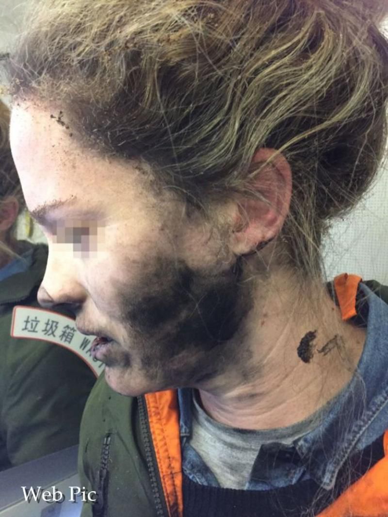 Căștile unei femei au explodat în timpul unei curse aeriene