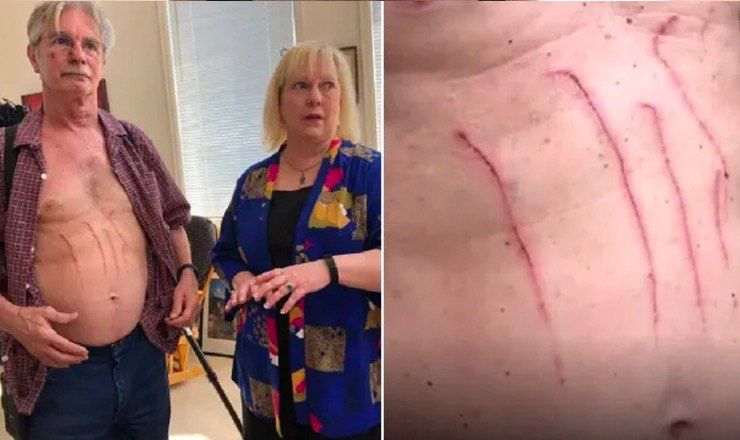 Нападение медведей на американцев попало на видео