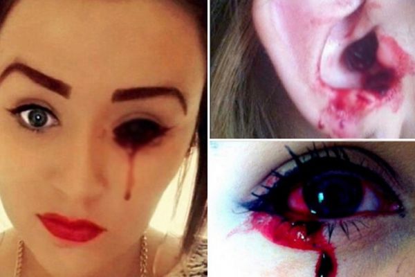 lacrimi de sange, medici