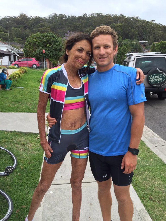 turia pitt, poveste