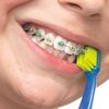 Зубная щетка детская для брекетов Curaprox Ortho Ultra Soft 