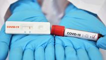 Cupa Mondială: Microbiștii vor fi obligați să prezinte test COVID