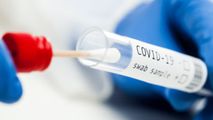 Bilanț: Încă 449 de infectări în Moldova. Câte teste au fost efectuate