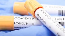Bilanț COVID: Peste 380 de noi infectați și 7 decese într-o săptămână