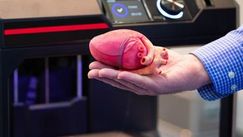 O nouă șansă la viață: A fost construită prima inimă artificială