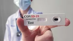 Bilanț: Încă 732 de infectări în Moldova. Câte teste au fost efectuate