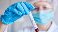 Bilanț: Încă 576 infectați în R. Moldova. Topul regiunilor afectate