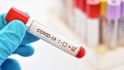 Bilanț: Încă 196 de infectați în R. Moldova. Topul regiunilor afectate