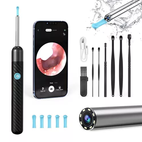 cumpără Dispozitiv p/u îngrijirea feței miscellaneous Ear Wax Removal Kit Y8 with Wi-Fi, 2MP Camera în Chișinău 