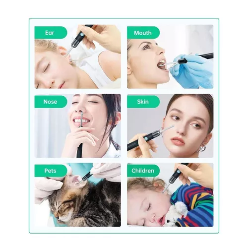 cumpără Dispozitiv p/u îngrijirea feței miscellaneous Ear Wax Removal Kit Y8 with Wi-Fi, 2MP Camera în Chișinău 