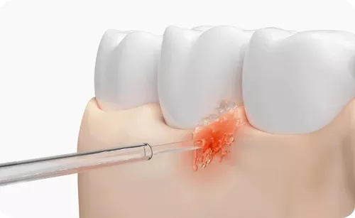 купить Ирригатор Xiaomi Water Flosser 2 EU в Кишинёве 