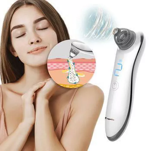 купить Прибор для ухода за лицом inSPORTline 6052 Aparat de curatare pori IN23082 Suckage в Кишинёве 