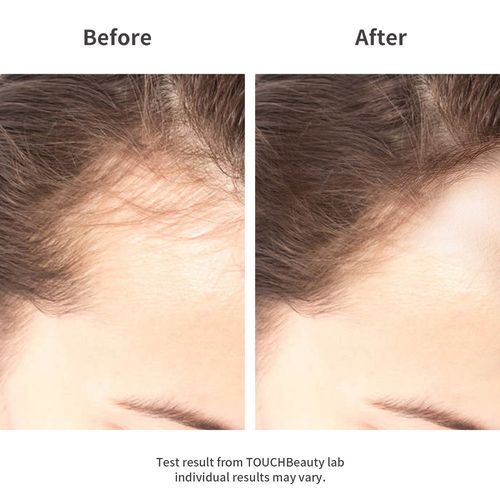 купить Аксессуар для дома Touch Beauty RF Hair Care Comb в Кишинёве 