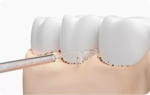 купить Ирригатор Xiaomi Water Flosser 2 EU в Кишинёве 