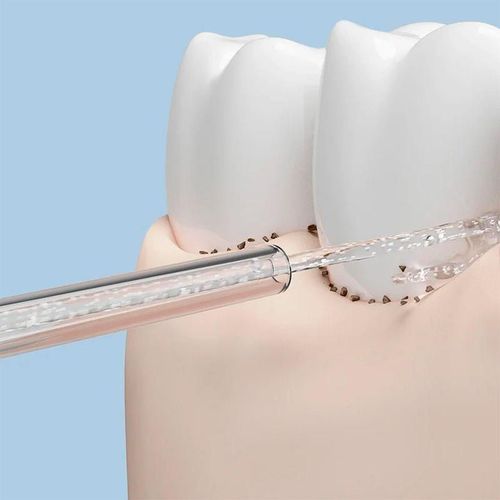 cumpără Rezervă pentru periuța de dinți Xiaomi Water Flosser Replacement Tips în Chișinău 