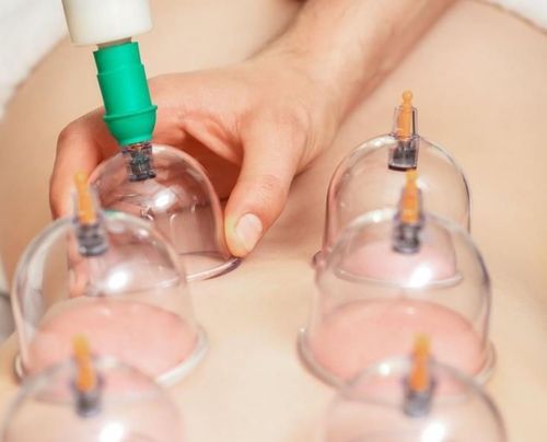 cumpără Dispozitiv de masaj mecanic miscellaneous 11448 Set de ventuze cu pompa (24 buc.) 10050 în Chișinău 